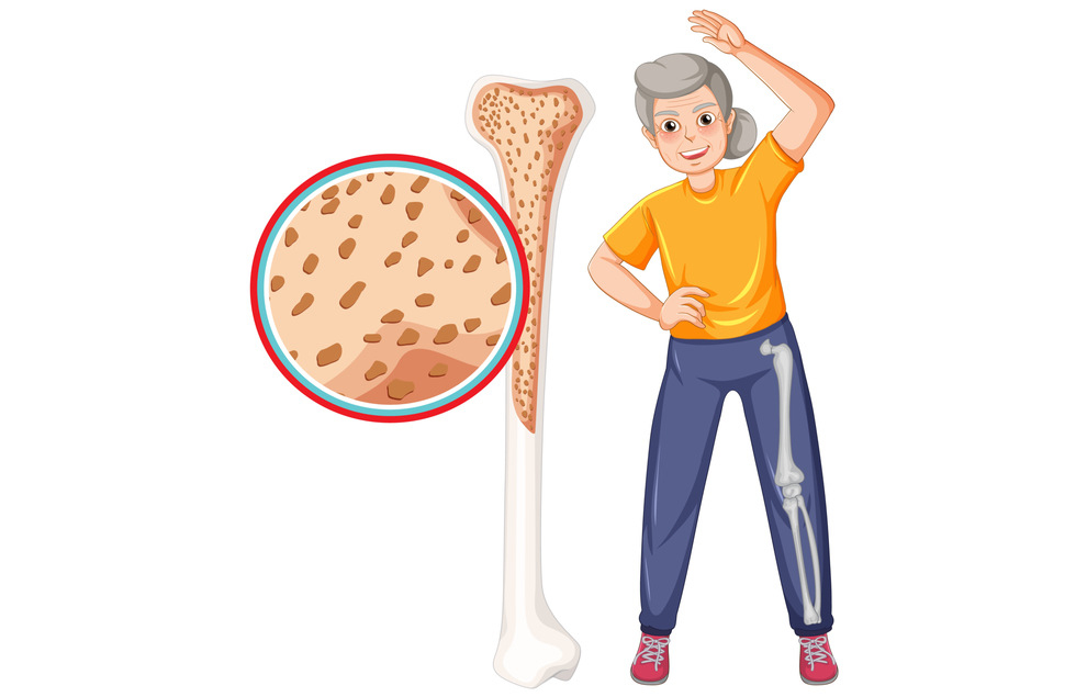 how-menopause-affects-bone-density-fitourney